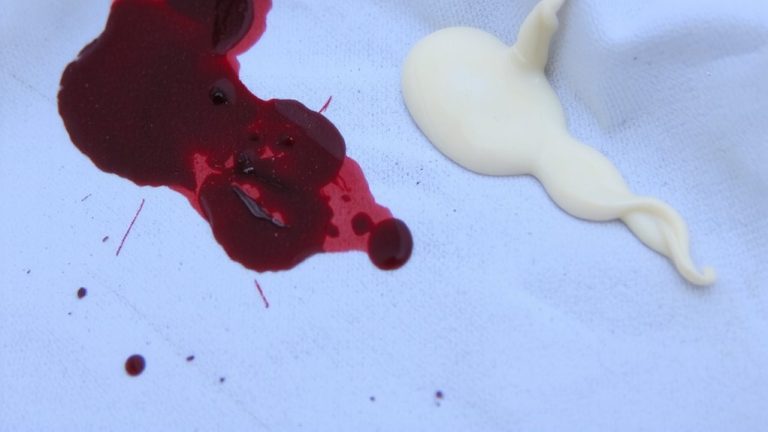 protein based stains resist cleaning